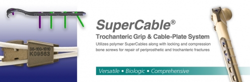 SuperCable Grip & Plate System