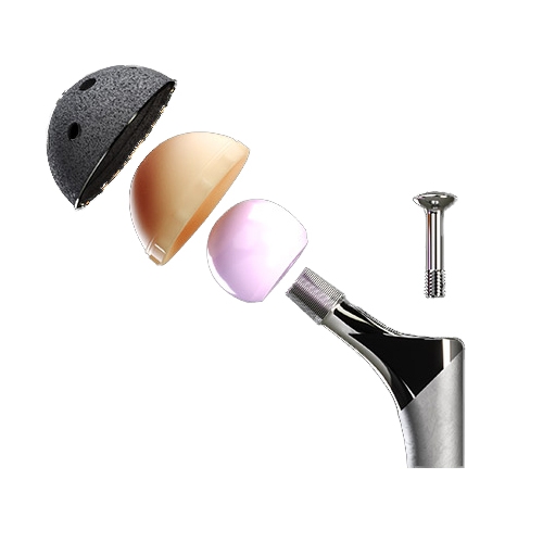 Exprt Revision Hip by DJO Surgical