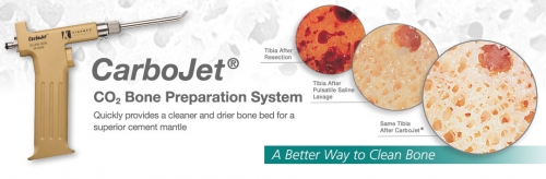 CarboJet CO2 Bone Preparation System